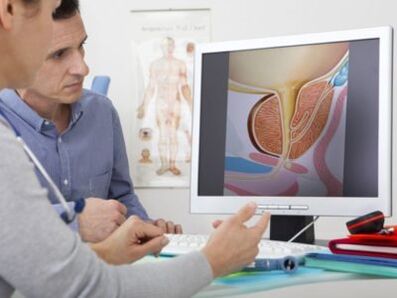 A urologist consults a patient about problems with potency